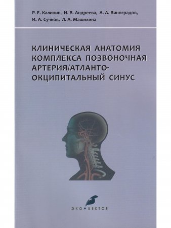 Клиническая анатомия комплекса позвоночная артерия/атланто-окципитальный синус
