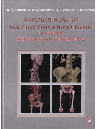 Мультиспиральная компьютерная томография в клиниках медицинского университета