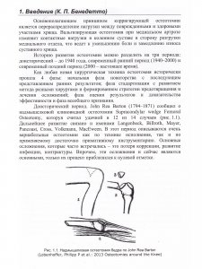 Остеотомии в области коленного сустава