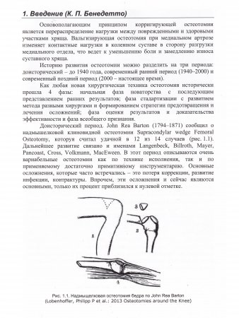 Остеотомии в области коленного сустава