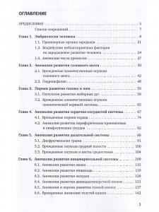 Эмбриональная патология человека: аномалии и пороки развития органов и систем
