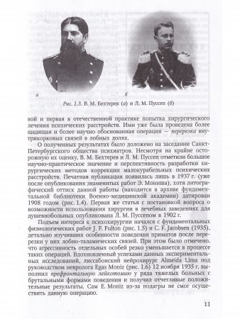 Функциональная нейрохирургия в лечении нервных и психических заболеваний