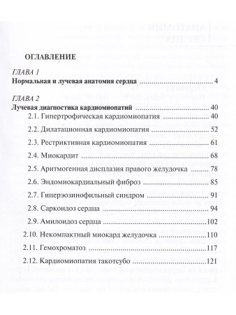 Лучевая диагностика кардиомиопатий