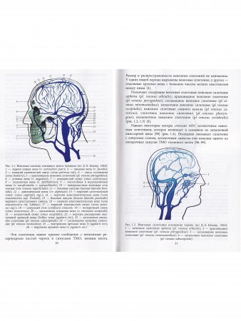 Клиническая анатомия комплекса позвоночная артерия/атланто-окципитальный синус