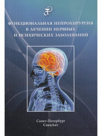 Функциональная нейрохирургия в лечении нервных и психических заболеваний