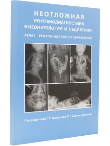 Неотложная рентгенодиагностика в неонатологии и педиатрии (Атлас рентгеновских изображений). Руковод