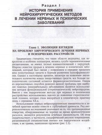 Функциональная нейрохирургия в лечении нервных и психических заболеваний