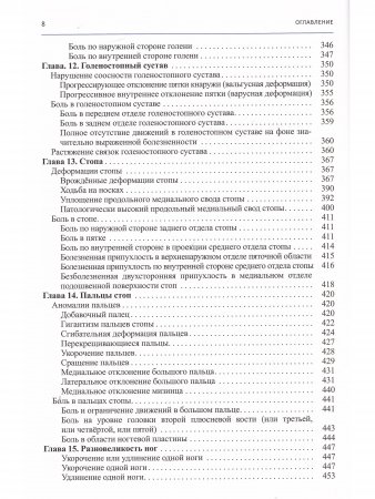 Детская ортопедия