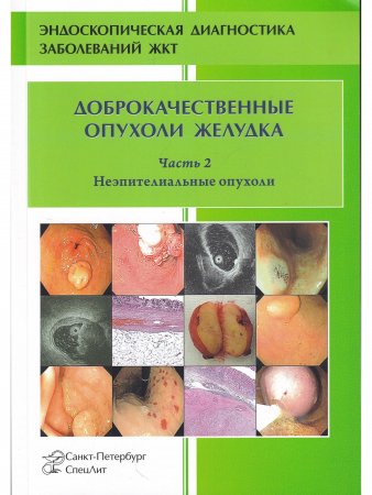 Доброкачественные опухоли желудка.Часть 2 Неэпителиальные опухоли