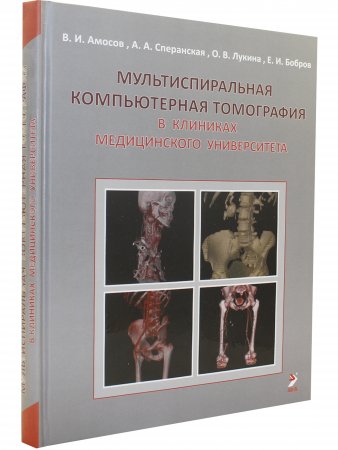 Мультиспиральная компьютерная томография в клиниках медицинского университета