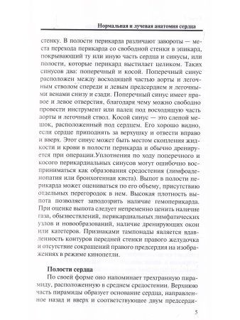 Лучевая диагностика кардиомиопатий