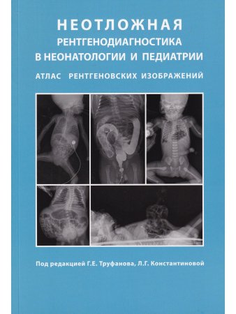 Неотложная рентгенодиагностика в неонатологии и педиатрии (Атлас рентгеновских изображений). Руковод