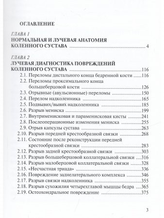 Лучевая диагностика повреждений коленного сустава