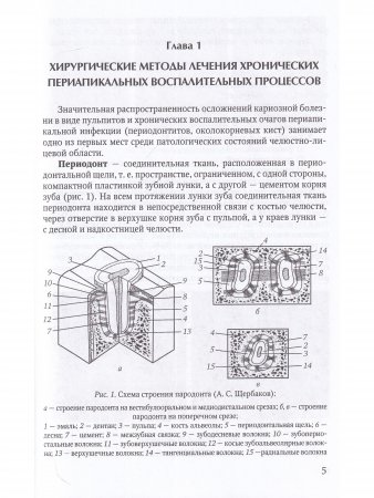 Резекция верхушек корней зубов - лечение периапикальных процессов.Учебное пособие