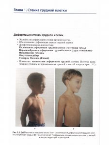 Детская ортопедия