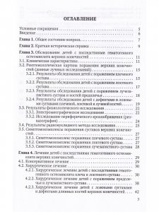 Ортопедические последствия гематогенного остеомиелита верхних конечностей у детей