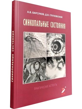Синкопальные состояния: практические аспекты