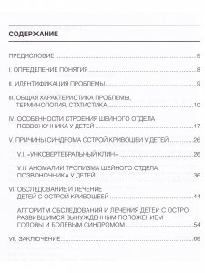 Острая кривошея у детей: Пособие для врачей