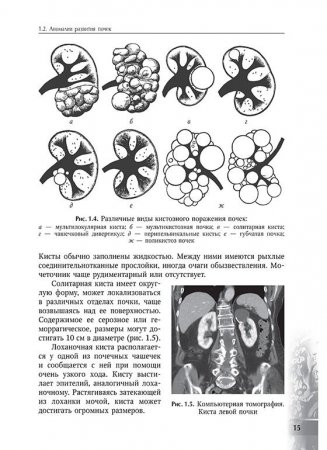 Урология детского возраста