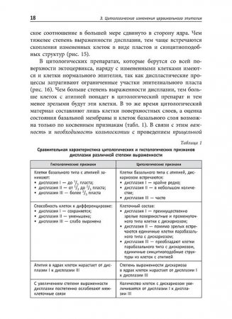 Кольпоскопия