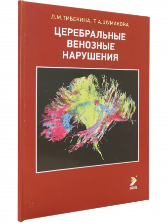 Церебральные венозные нарушения