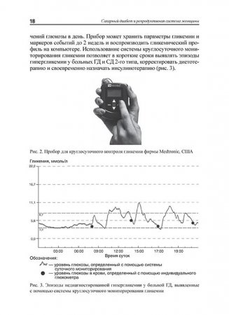 Сахарный диабет и репродуктивная система женщины: пособие для врачей