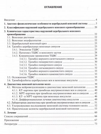 Церебральные венозные нарушения