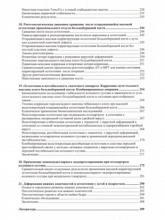 Остеотомии в области коленного сустава