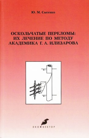 Оскольчатые переломы: их лечение по методу академика Г.А. Илизарова