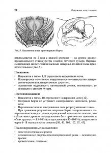 Недержание мочи у женщин: современные возможности консервативного и хирургического лечения: