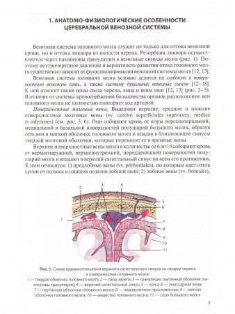 Церебральные венозные нарушения
