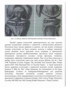 Остеотомии в области коленного сустава