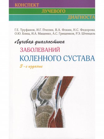 Лучевая диагностика заболеваний коленного сустава. (Конспект лучевого диагноста) 3-е издание.
